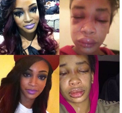 Over A Burger Though?: Girl Beat And Held Hostage For 3 Hours Over A Burger [Full Version]