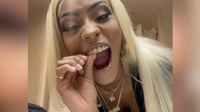Get Dental Insurance: Person Does Tutorial On How To Fix A Chipped Tooth!