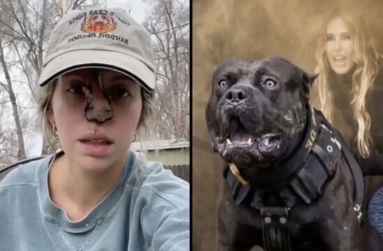 Woman Says She's Keeping Her Dog Of 11 Years Even Though He Bit Off Her Nose!